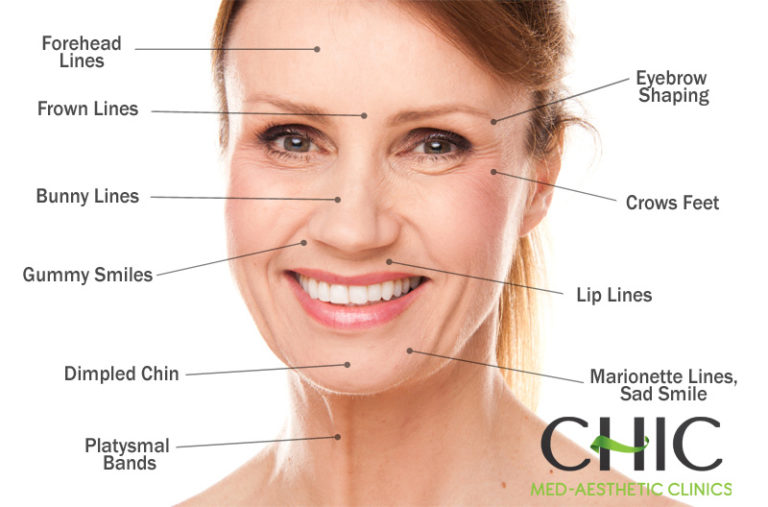 Botox Injections Chic Med Aesthetic Clinics